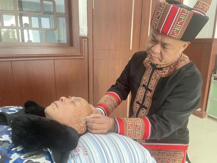 颊针疗法 颊针疗法